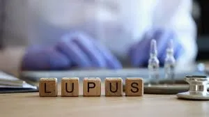 Médico especialista em lupus eritematoso sistemico Imagem
