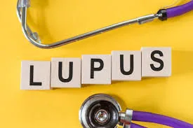Médico especialista em tratamento de lupus Imagem