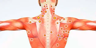 O melhor médico para tratamento de sindrome miofacial Imagem