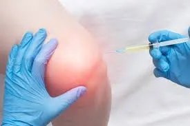 O melhor reumatologista para tratamento de dor no joelho Imagem