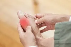 O melhor reumatologista para tratamento de gota Imagem